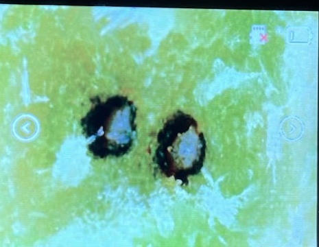 健全な株の葉柄の断面（顕微鏡）。緑の組織の中に、黒い輪が二つ見える。これが正常な見え方