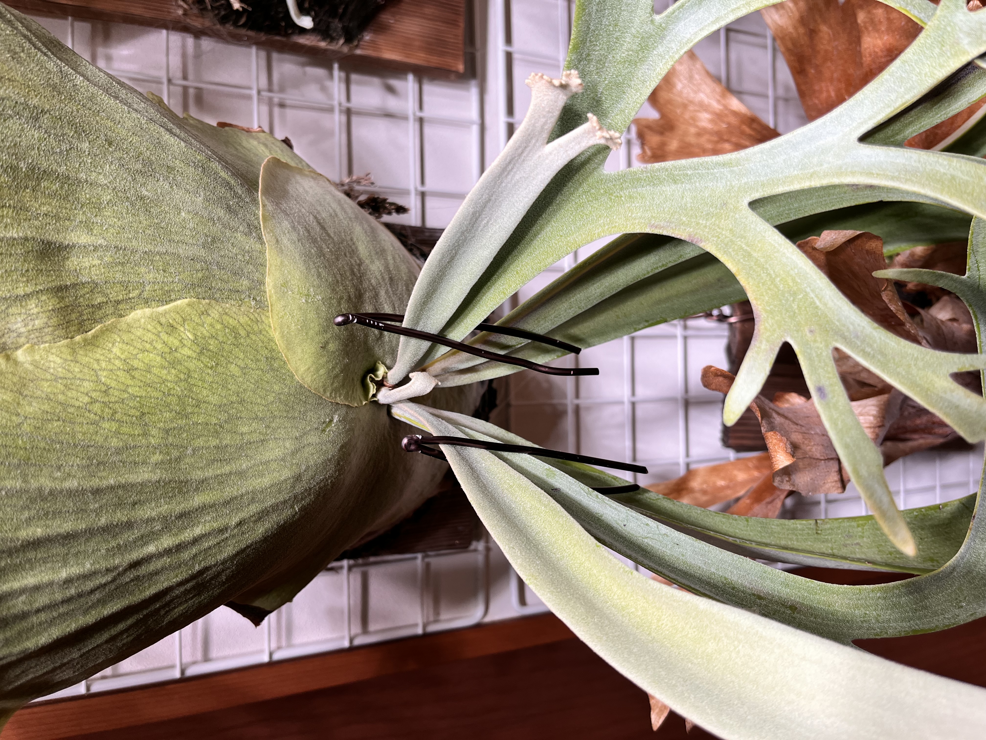 ヘアピンワイヤーを装着